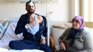 Usakta ucuz powerbank patladi Kullanici kalbinden agir yaralandi88534 0