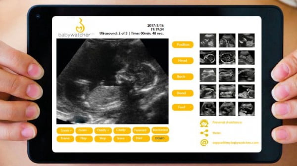 BabyWatcher Evinizdeki ultrason cihazı Donanım Günlüğü