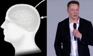 Elon Musk Neurolink