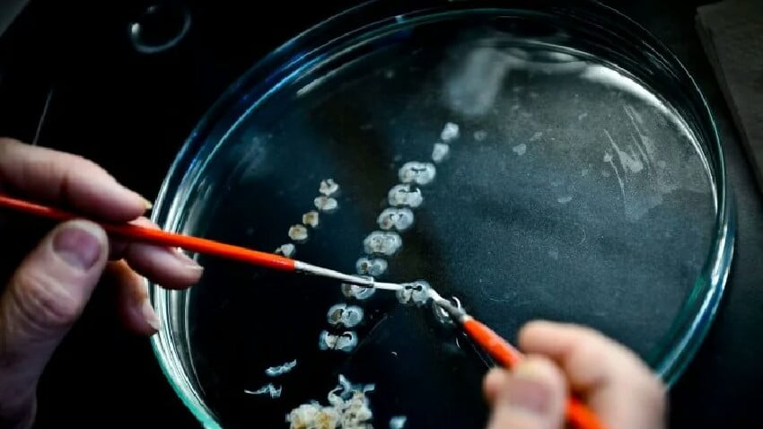 İnsandan insana kafa nakli