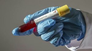 Anal koronavirüs testleri