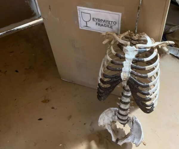 Ölen amcasının iskeletinden gitar yaptı: Skelecaster