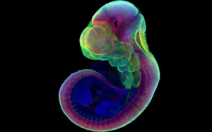 Hamilelik sona mı erecek? Yapay rahim kullanılarak embriyo büyütüldü! 23 Hamilelik sona mı erecek? Yapay rahim kullanılarak embriyo büyütüldü!