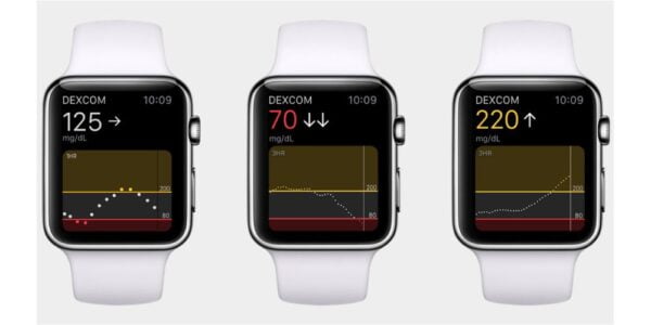 Apple Watch, kan şekerini takip edebilir!