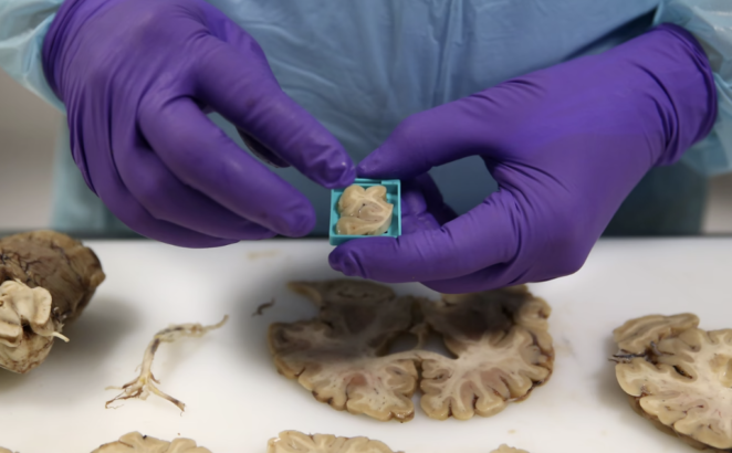 Bilim İnsanları Minik Beyinler Üretti! 13 Bilim İnsanları Minik Beyinler Üretti!