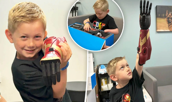 5 yaşındaki çocuk, biyonik kahraman kolunu kullanan dünyanın en genci oldu 32 biyonik kahraman kolu 3