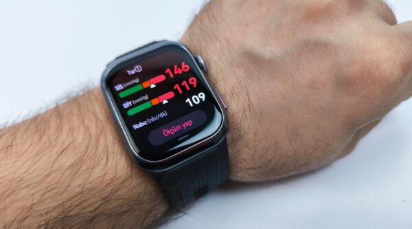 Huawei Watch D2 akıllı saat: Sağlık Bakanlığı'na kayıtlı medikal cihaz 2 Huawei Watch D2 akıllı saat: Sağlık Bakanlığı'na kayıtlı medikal cihaz